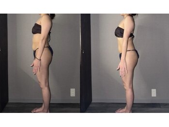 サロンスペース/40代 女性◆全身痩身 1回目