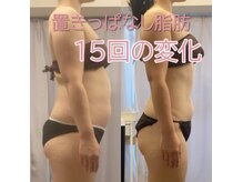シェリマ 西新宿(cheri.ma)