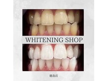 ホワイトニングショップ 徳島店の雰囲気（トーンアップで理想のお色味に近づけます！#ホワイトニング#徳島）