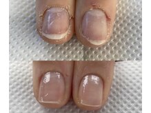 リコリサイア(ricco risaia)/美しいお爪に生まれ変わりました