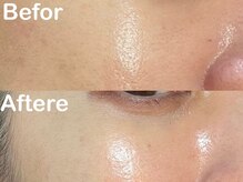 ベリア 広尾(BelLia)/リアボーテトリートメント