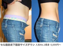 ピュアノア 垂水店/痩身ダイエット　神戸垂水明石