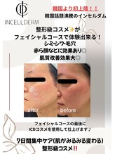 ヴィーナス 船橋駅前店(VENUS)/フェイシャルICD化粧品使用