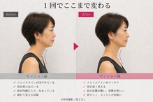 ライフ ピラティス スタジオ(LIFE Pilates Studio)