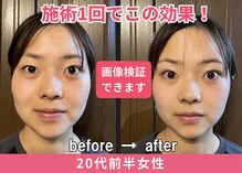 ドクターアーチ 神戸三宮 小顔矯正･整体サロン(Dr.ARCH)