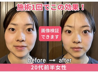 ドクターアーチ 神戸三宮 小顔矯正・整体サロン(Dr.ARCH)の写真