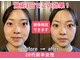 ドクターアーチ 神戸三宮 小顔矯正・整体サロン(Dr.ARCH)の写真
