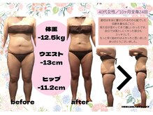 カルム エ コンポーゼ(Calme et Compose')の雰囲気（ただ痩せるだけじゃない！気になる部分までしっかりスッキリ☆）