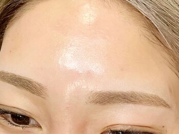 ベリンダ(BELINDA)/フェイスワックス脱毛