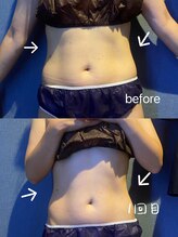 優来 神田店/お腹腸揉みスッキリ［神田］