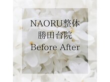 ナオル整体 勝田台院(NAORU整体)/施術事例【２０代女性】猫背