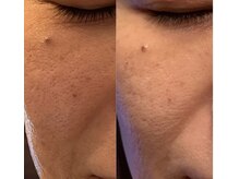 シキ(SIKI)/Eライト！RFラジオ派搭載