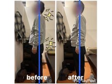 カワル整体 上通り院/趣味のボーリングができない...