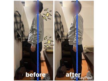 カワル整体 上通り院/趣味のボーリングができない...