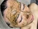 ベルティーク(BELTHEQUE)の写真/ふと目につく毛穴悩み【ハーブピーリング/ララピール】で“肌質改善”根本アプローチ◎