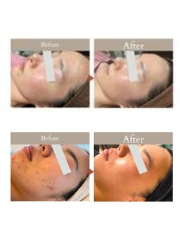 ラグラン銀座メディカルエステ 高輪ゲートウェイ店/医療提携だからこそ叶う外見美