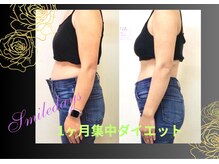 スマイルデイズ(Smiledays)/1ヵ月集中痩身