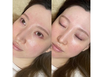 アイラッシュ ティル(eyelash till)の写真