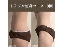 サロンドペシェ(salon de peche)/トリプル痩身ケアコース3回