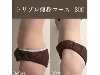 サロンドペシェ(salon de peche)/トリプル痩身ケアコース3回
