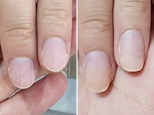 ウル(Uru)/ネイルケア/小さい・丸い爪