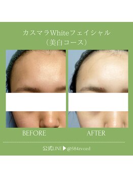 フィールグルック(Viel Gluck)/スペイン産高級パックで美肌効果