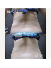 ヴィオテラス(VIOTERACE)/★腰回り☆