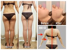 ナナ 銀座(Nana)/◆痩身と小顔両方結果重視◆