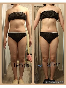 リープ(Lieb)/ビフォーアフター