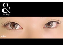 ヴィライズ 船橋(VIRISE)/after　アンドヘルシー