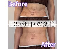 リトリート(Retreat)