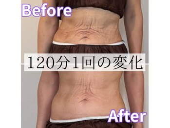 リトリート(Retreat)