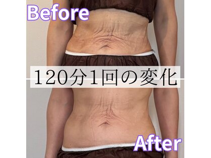 リトリート(Retreat)の写真