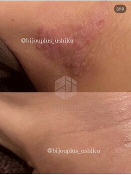 ビジュープラス ひたち野うしく店(Bijou+)/