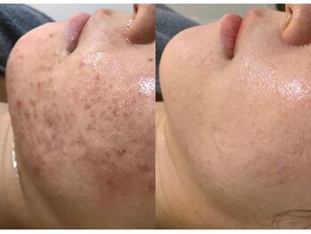 ライブリー(LIVELY)/