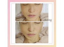 シェリングの雰囲気（人気！素肌美フェイシャルで若々しい印象に！ハリ.弾力小顔に◎）