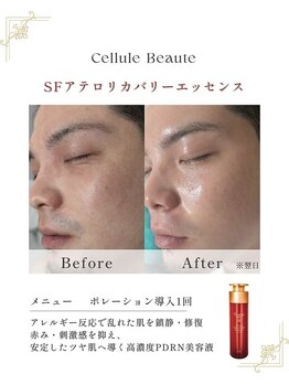 チャンティック (CANTIK)/ 韓国大人気PDRN美容液