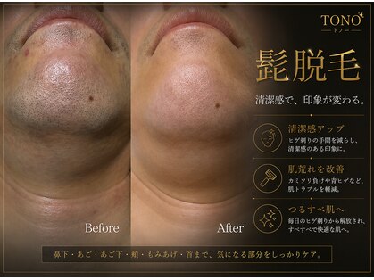 トノ(TONO)の写真
