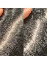 シュール センター南(SURREAL)/ヘッドスパ後のビフォーアフター