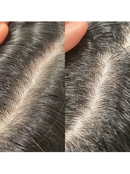 シュール センター南(SURREAL)/ヘッドスパ後のビフォーアフター