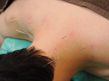 東園田鍼灸整骨院/鍼灸