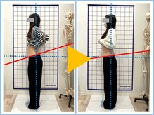クリア整骨院 仙台東口/施術評価