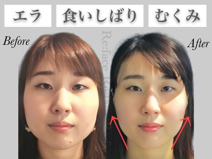 リフェイス(Re:face)の写真