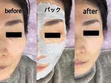 シェリー(Cheri)/ビタミンC×水光パック