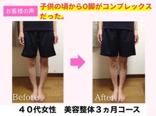 よしみち整体院/オール美容整体でO脚が改善♪