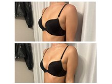 背中や肩まわりをほぐし、肋骨を絞めることでバストアップに♪