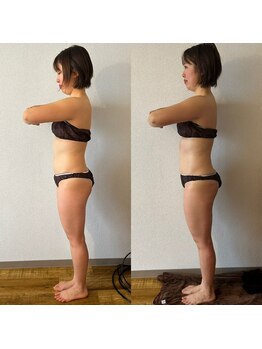 サロン マイワン(Salon MyONE)/全身ビフォーアフター側面