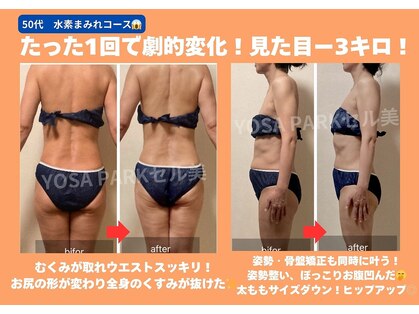 ヨサパーク セルヴィ(YOSA PARK セル美)の写真