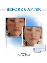 ドルチェビューティーサロン 戸塚安行店(Dolce Beauty Salon)/ダクトピール