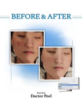 ドルチェビューティーサロン 戸塚安行店(Dolce Beauty Salon)/ダクトピール